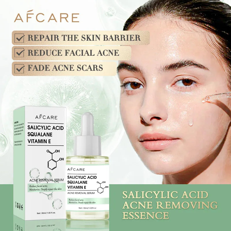 Acne Removing Moisturizing Face Serum